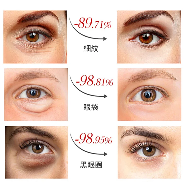 滬美24K黃金瑩潤眼膜,美容院同步使用 輕鬆解決各種眼部問題 滬美24K黃金瑩潤眼膜,美容院同步使用 輕鬆解決各種眼部問題