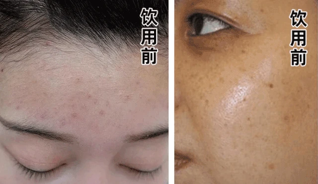 1679142997329153.png ac69198b32c8d802fa74968704f708a.png