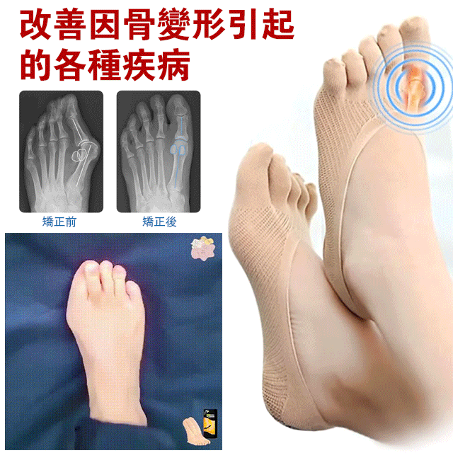買六送六 消腫緩痛五指襪 免運費 七天鑑賞期 買六送六 消腫緩痛五指襪 免運費 七天鑑賞期